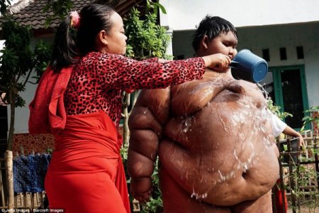 Дэлхийн хамгийн тарган 10 настай хүү 192 кг жинтэй